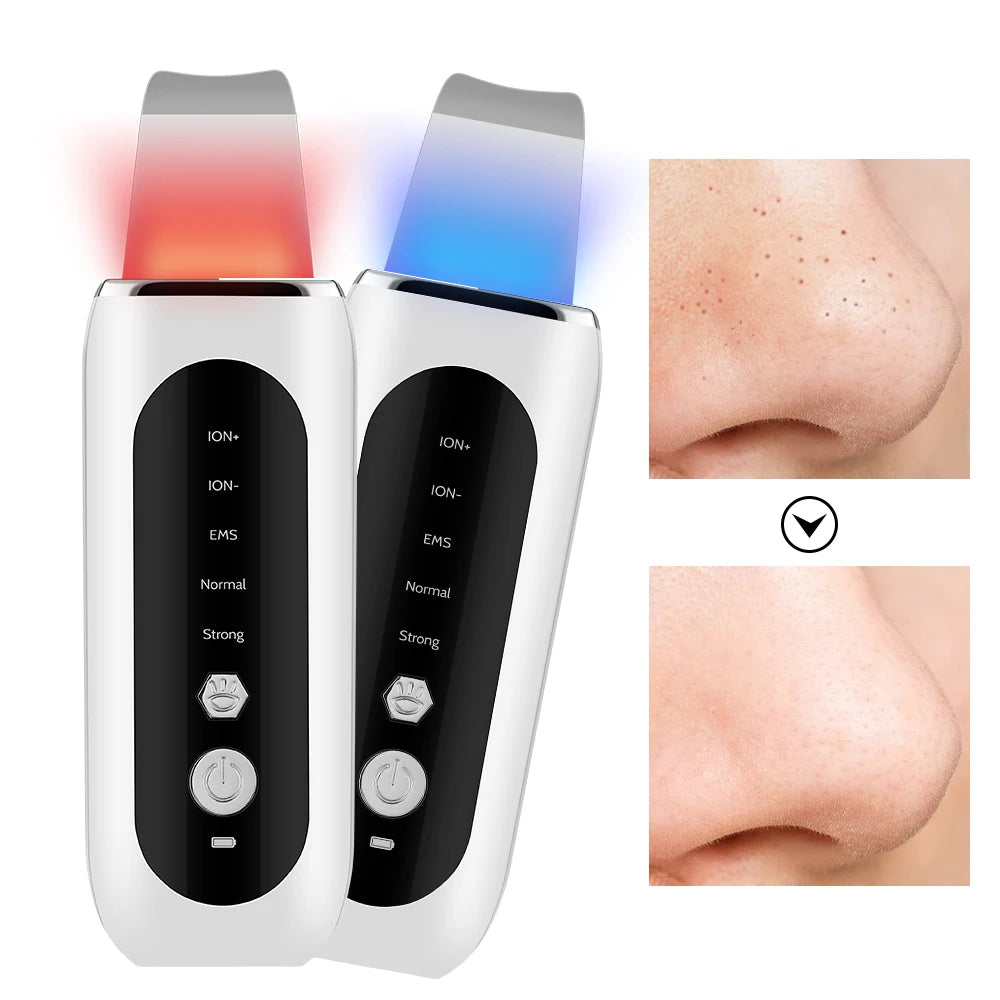 Ultrasonic Deep Cleansing Facial Spatula – Blackhead Exfoliating Shovel & EMS Lifting Device