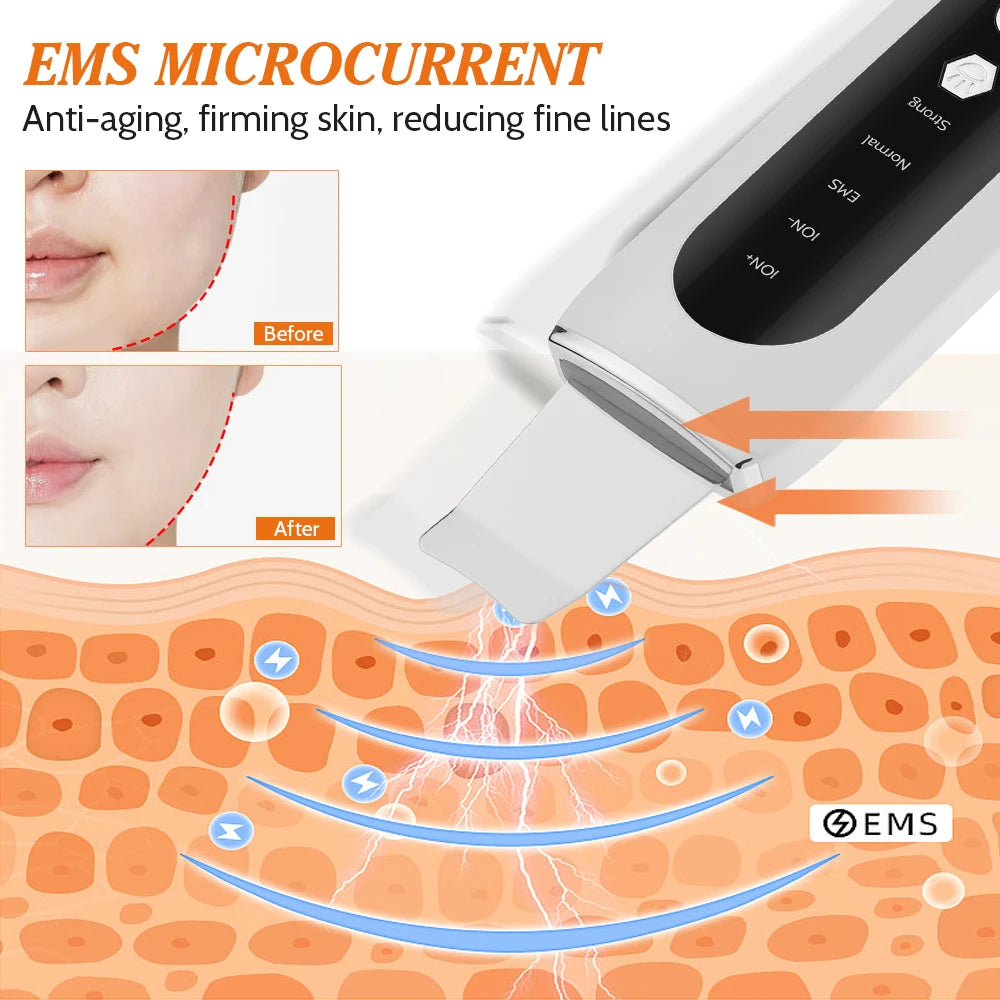 Ultrasonic Deep Cleansing Facial Spatula – Blackhead Exfoliating Shovel & EMS Lifting Device