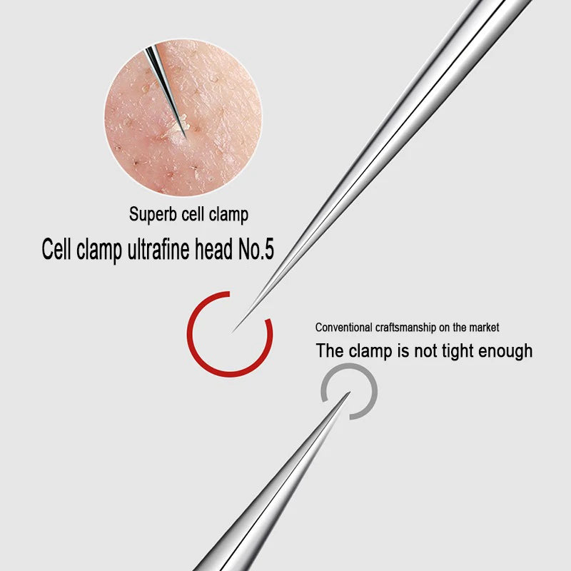 Professional Stainless Steel Blackhead Removal Set (4–5 Pcs) – Acne Needles & Precision Tweezers