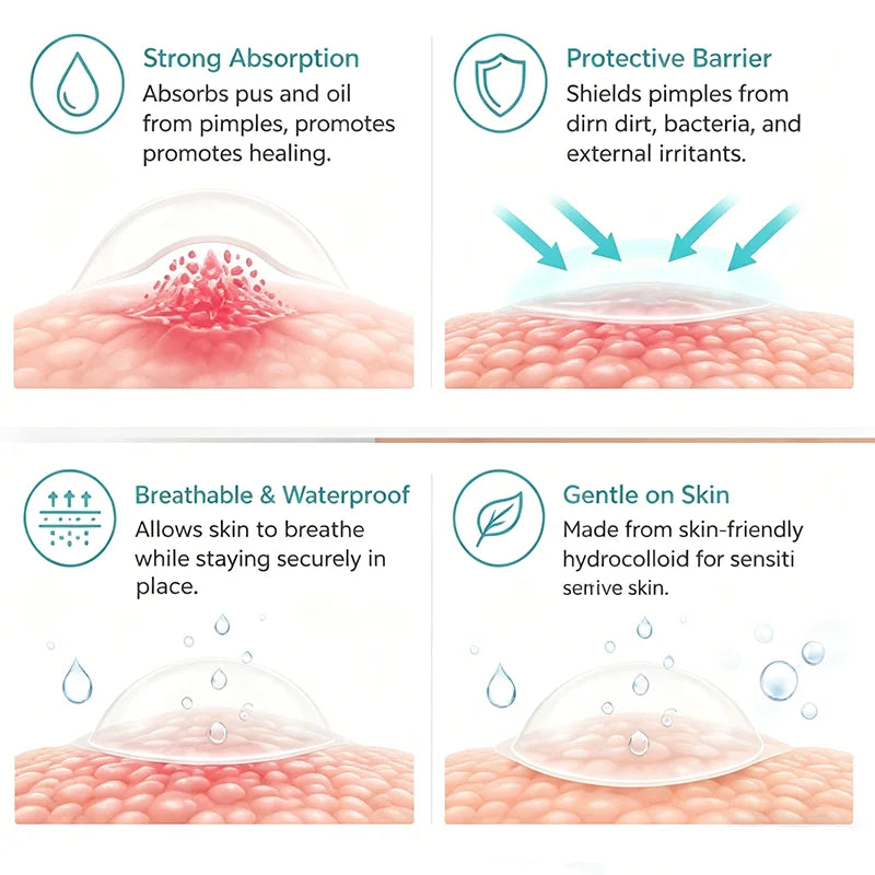 360Pcs Invisible Hydrocolloid Acne Patches – Breathable Blemish & Spot Healing Cover