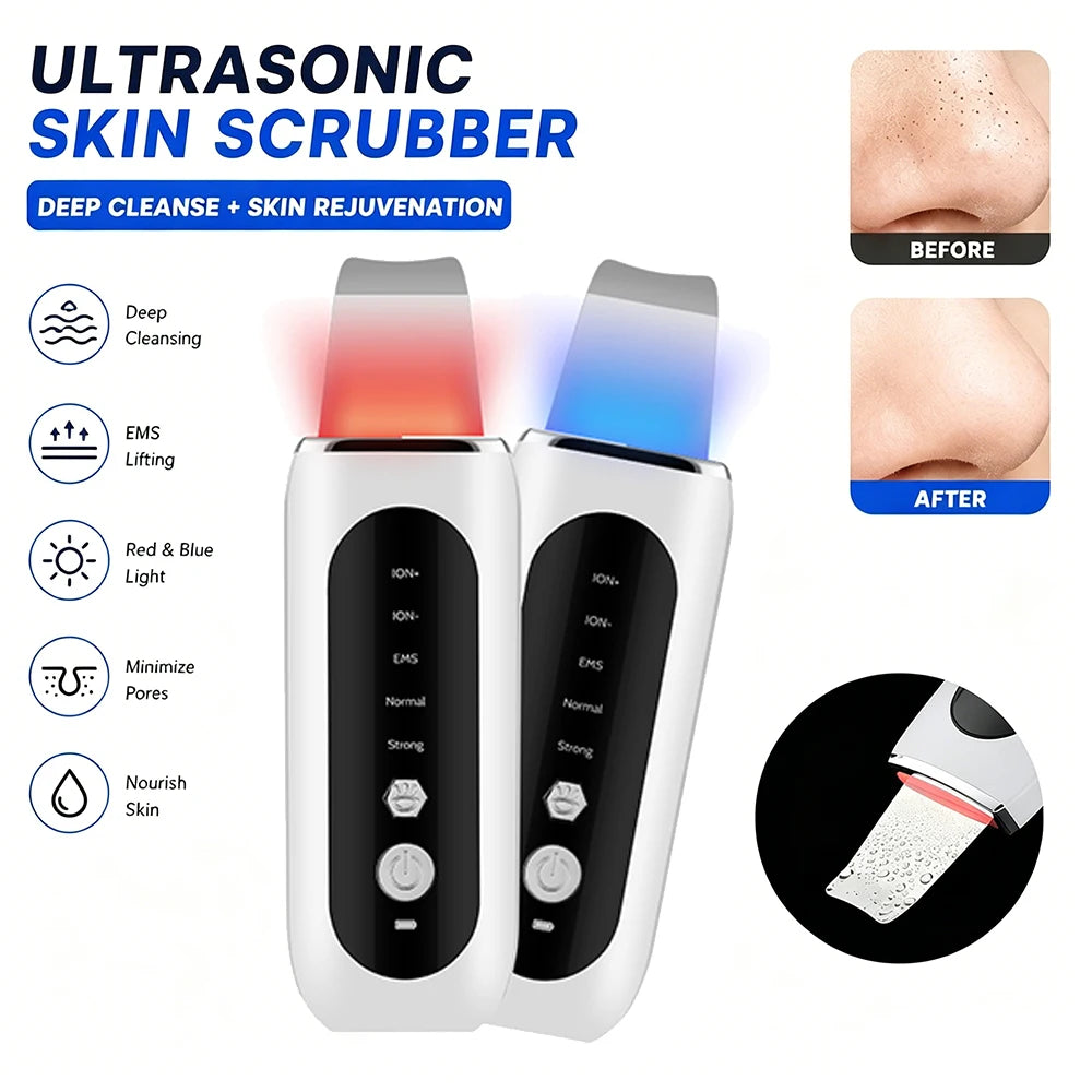 Ultrasonic Deep Cleansing Facial Spatula – Blackhead Exfoliating Shovel & EMS Lifting Device