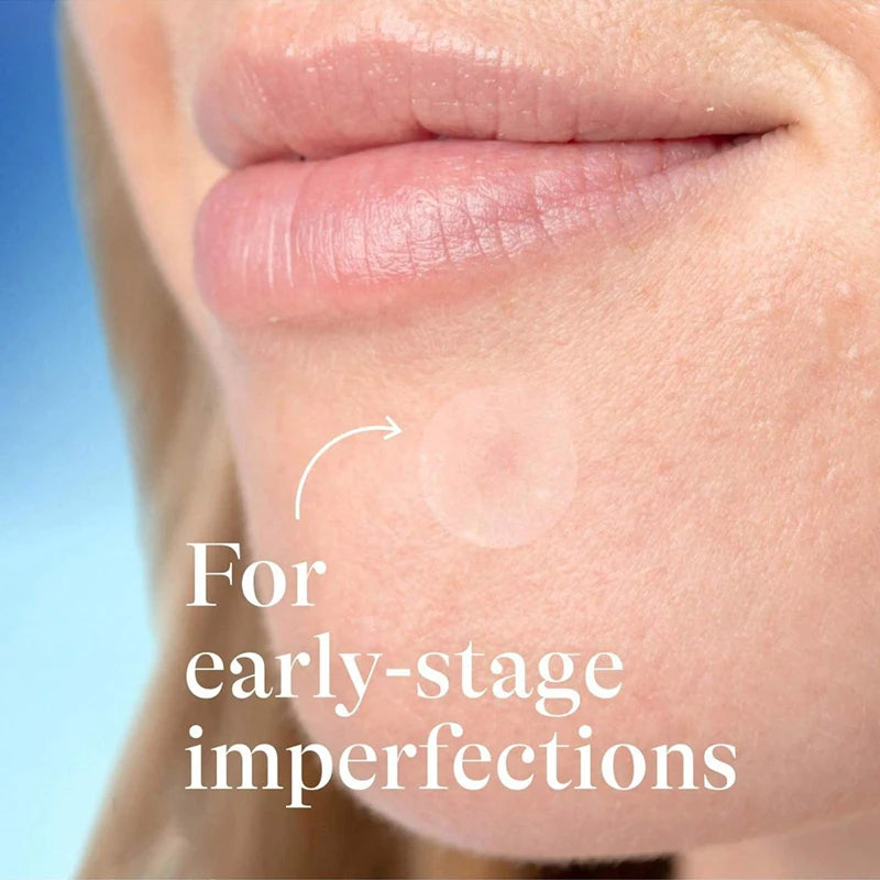 360Pcs Invisible Hydrocolloid Acne Patches – Breathable Blemish & Spot Healing Cover