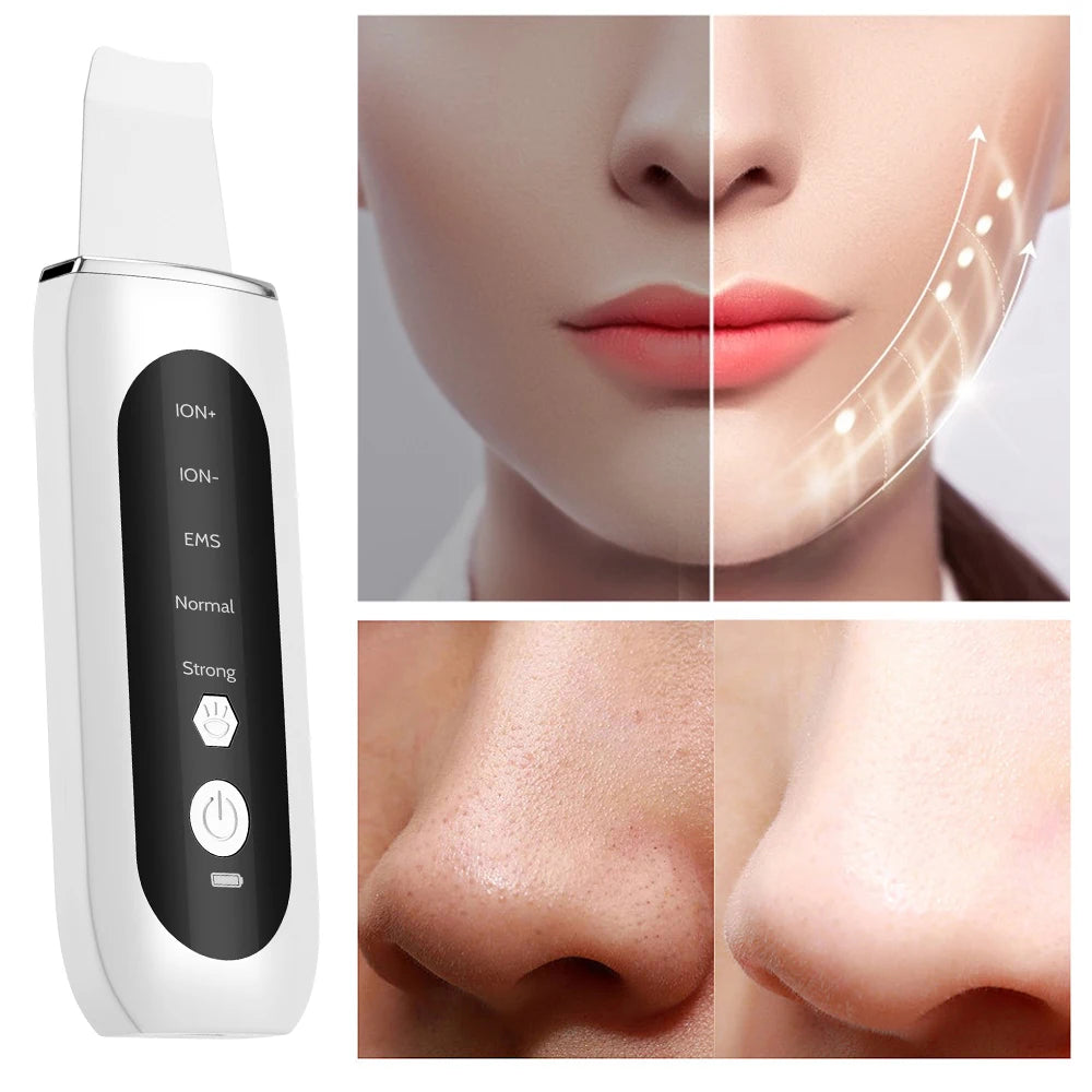 Ultrasonic Deep Cleansing Facial Spatula – Blackhead Exfoliating Shovel & EMS Lifting Device